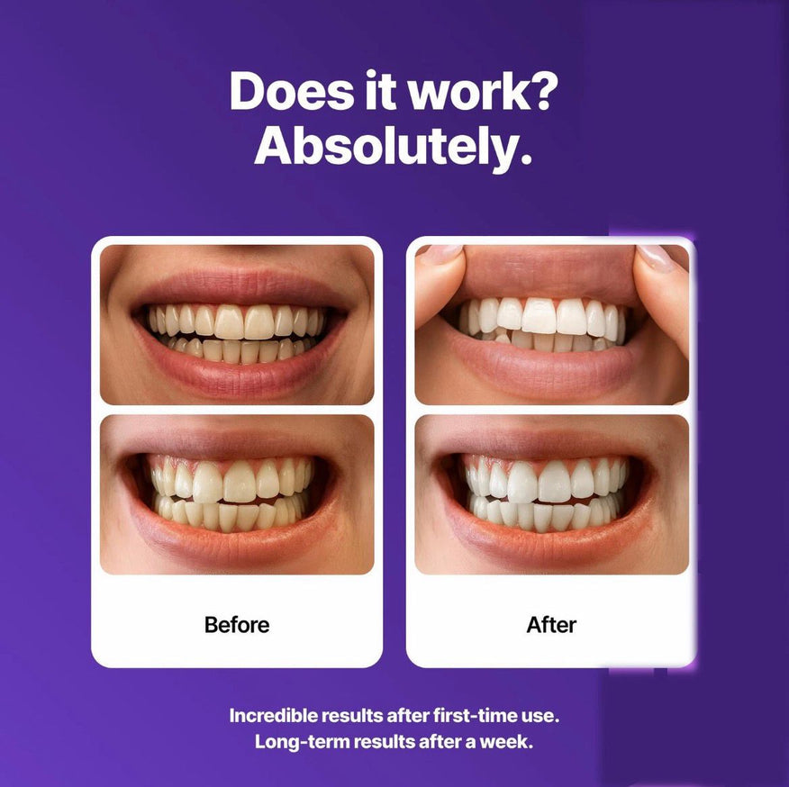 Whitening Teeth Strips Purple Teeth Strips Dry-application